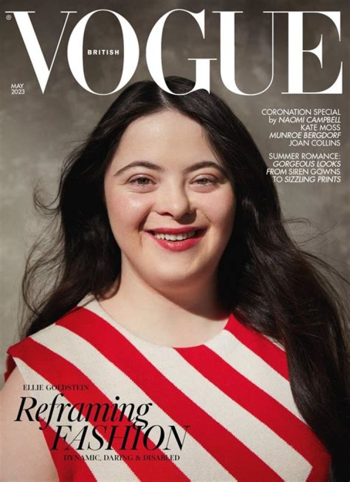 Down Syndrome Photoshoots Unveiled For True Inclusivity