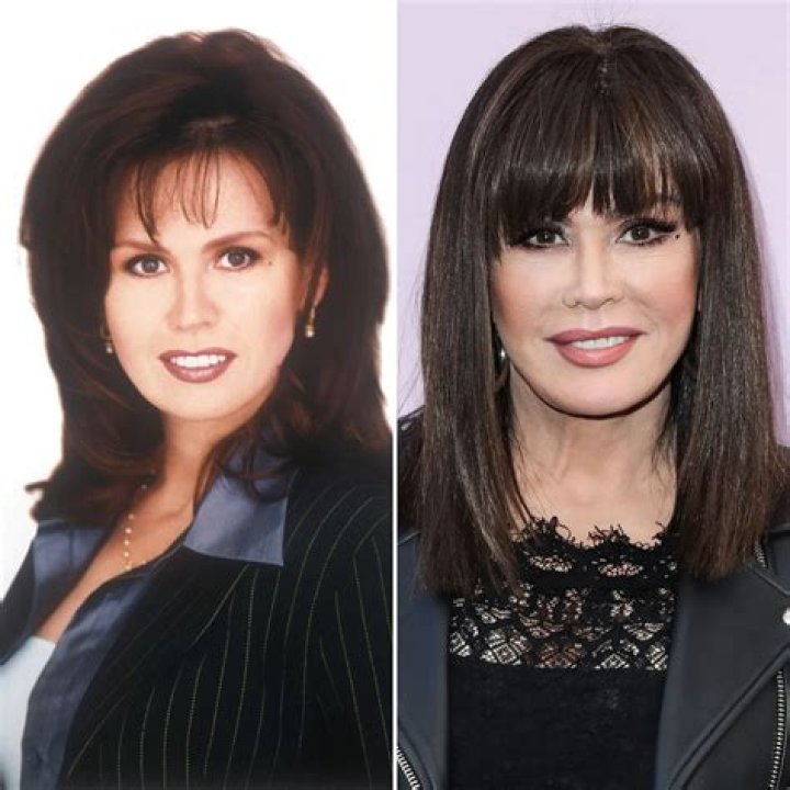 Marie Osmond's Plastic Surgery Journey: Uncovering Surprising Revelations